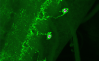 Crawling to an understanding of early events in Parkinson’s.