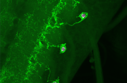 Crawling to an understanding of early events in Parkinson’s.